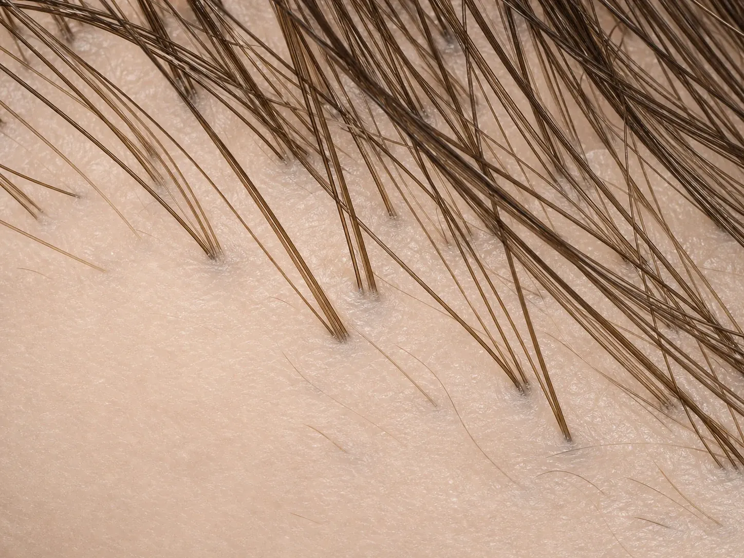 Combination of a scalp close-up with visible hair follicles and an artistic active-ingredient still life